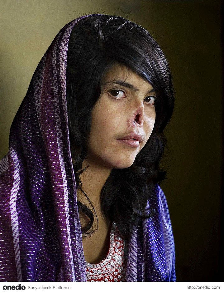 Cesaret; Babası tarafından kocasına satılan bu Afgan kız, kocasından kaçtığında ise kulakları ve burnu kesilerek cezalandırılıp tekrar kocasının yanına döndürüldü.