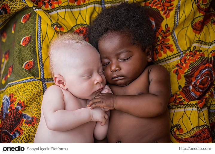 Siyahi bir bebek, albino bir bebeğin elini tutarken.