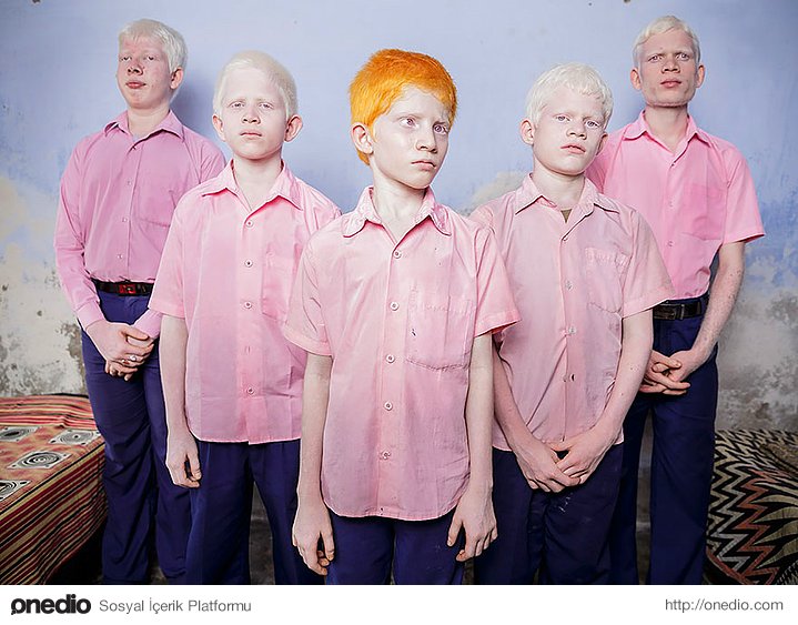 Hindistan'da Vivekananda Okulu'ndaki görme engelli albino öğrenciler.
